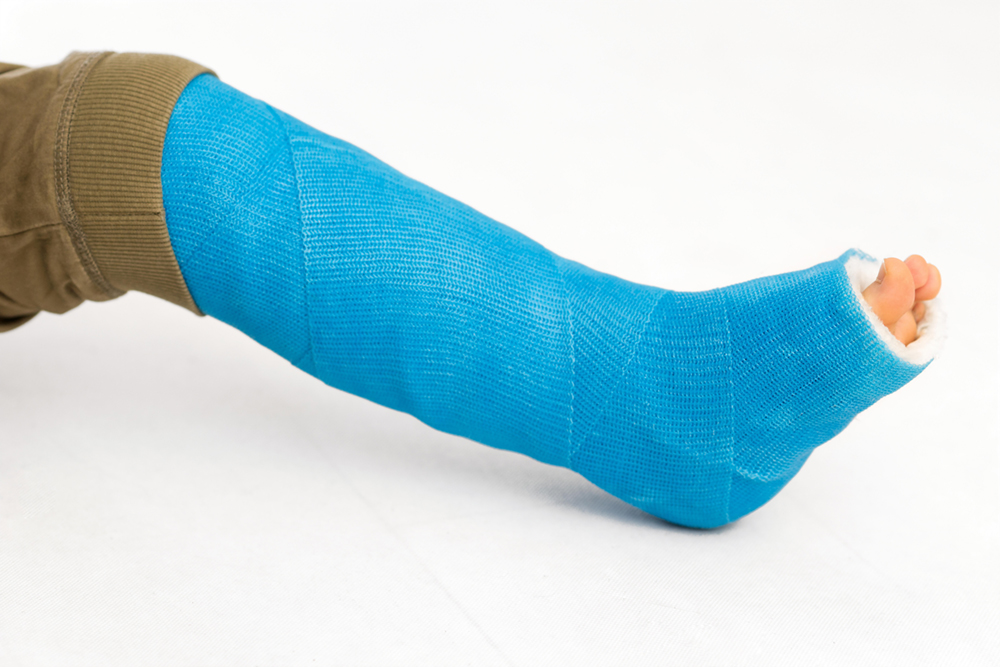 Treating Foot Fractures With Bone Stimulators